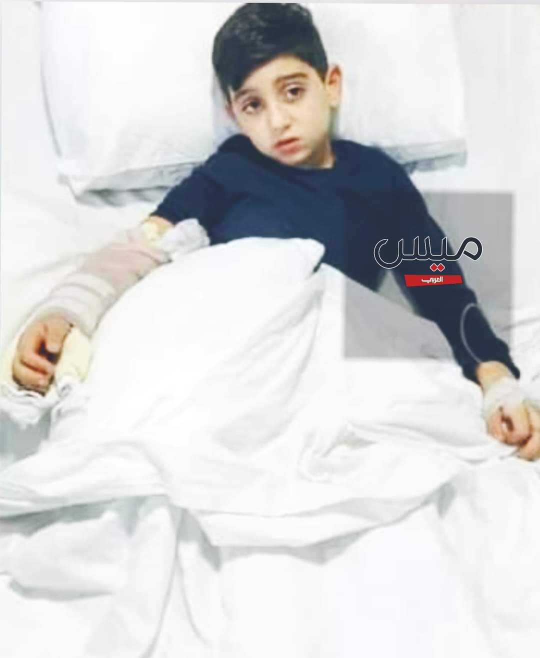  الطفل الجنوبي محمد يسلم الروح في المستشفى بعد دخوله لعلاج بسيط..*   