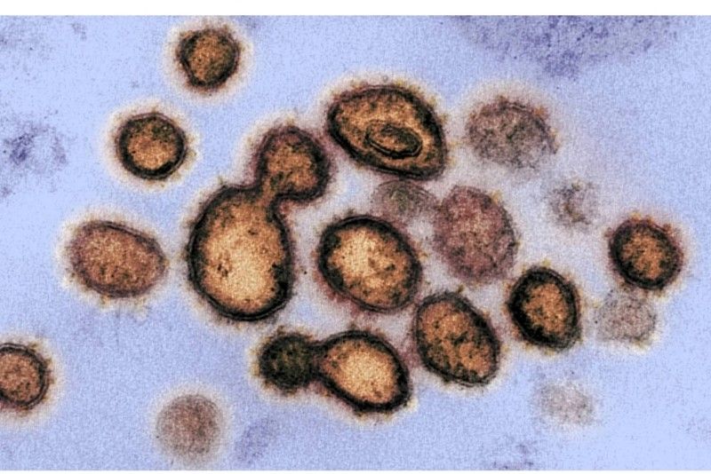 فيروس كورونا المستجد ينتشر في 45 دولة وبؤر جديدة للوباء بعد الصين السعودية تعلّق 