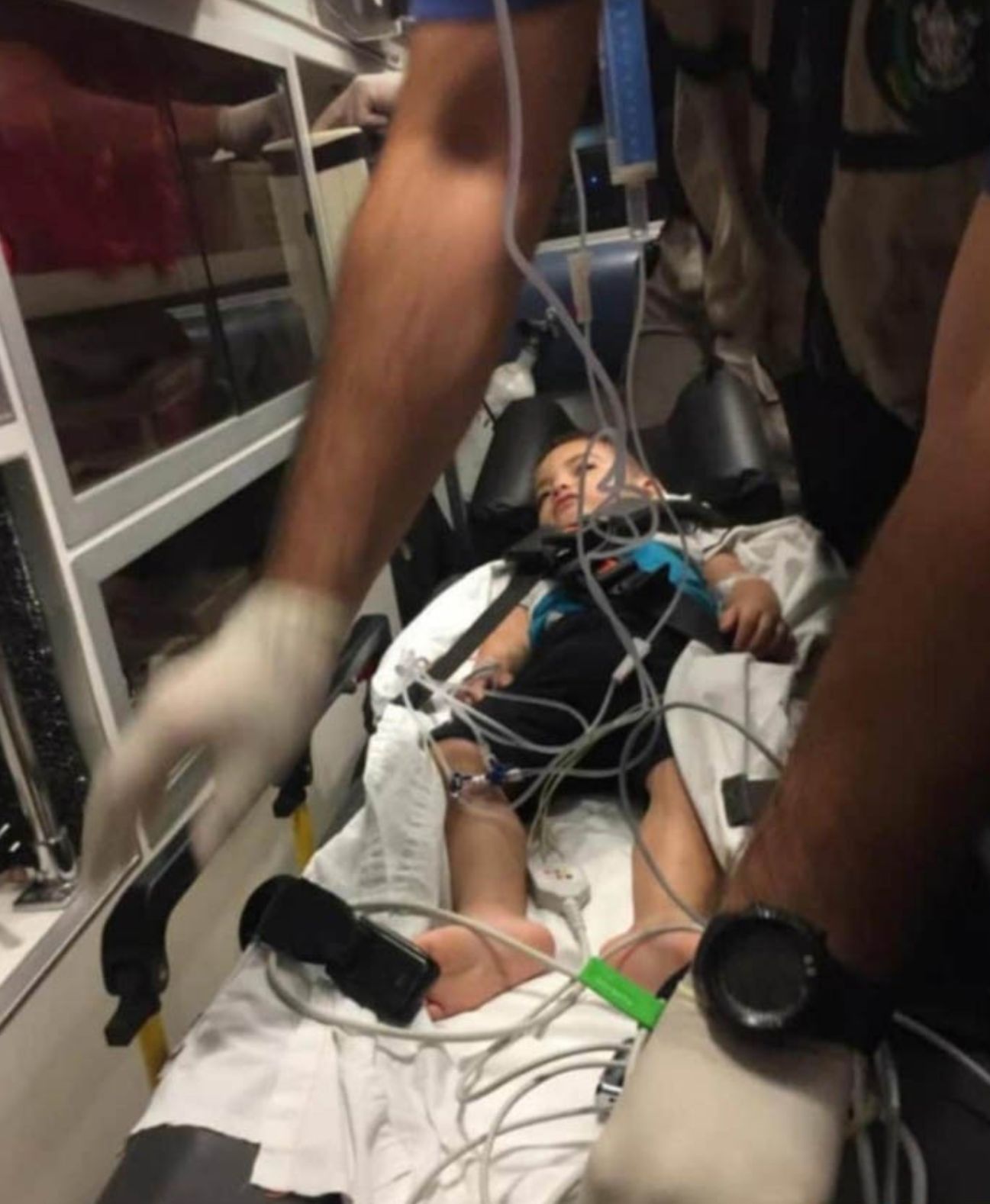 الطفل 'حسين' اصيب بكسور في رأسه جراء سقوطه عن الطابق الأول... وهو الآن بحاجة ماسة لدعائكم