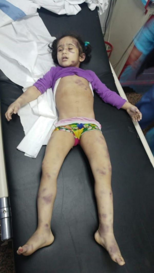 ضربها والدها حتى الموت... الطفلة السورية ذات ال5 سنوات وصلت جثة الى المستشفى