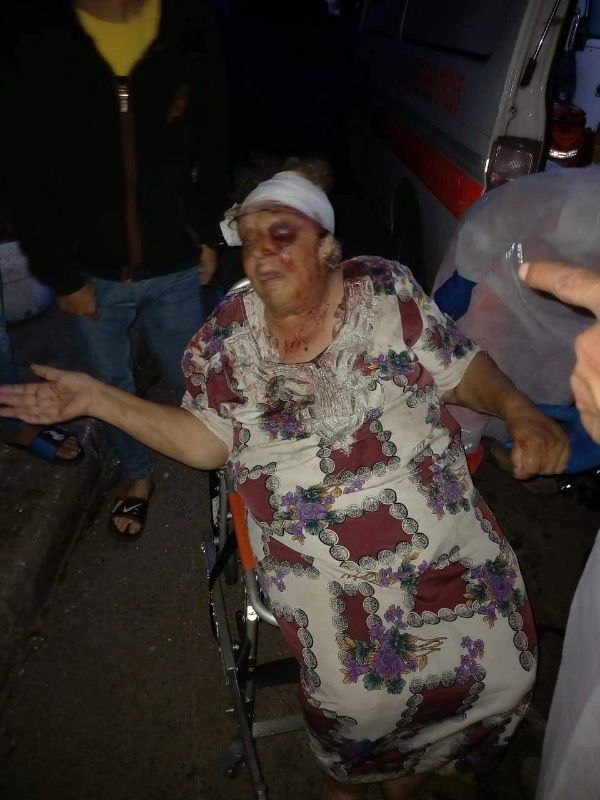 بالصور: بعد ان تداول ناشطون ليل امس فيديو يظهر من خلاله امرأة مسنه تعرضت للضرب